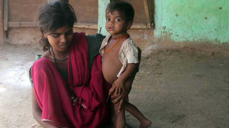 <strong>‘विकसित’ गुजरात के आदिवासी इलाकों में कुपोषित बच्चों की संख्या में बढ़ोतरी</strong>
