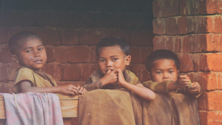 गुजरात में 1.25 लाख से अधिक कुपोषित बच्चे, आदिवासी जिला नर्मदा लिस्ट में सबसे ऊपर